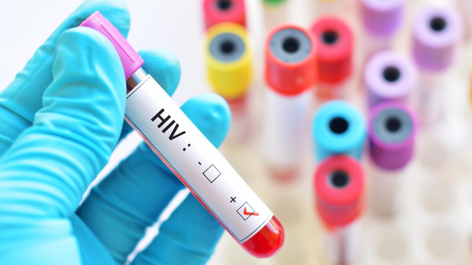 HIV virus, medical concept, Human Immunodeficiency Virus Positive test